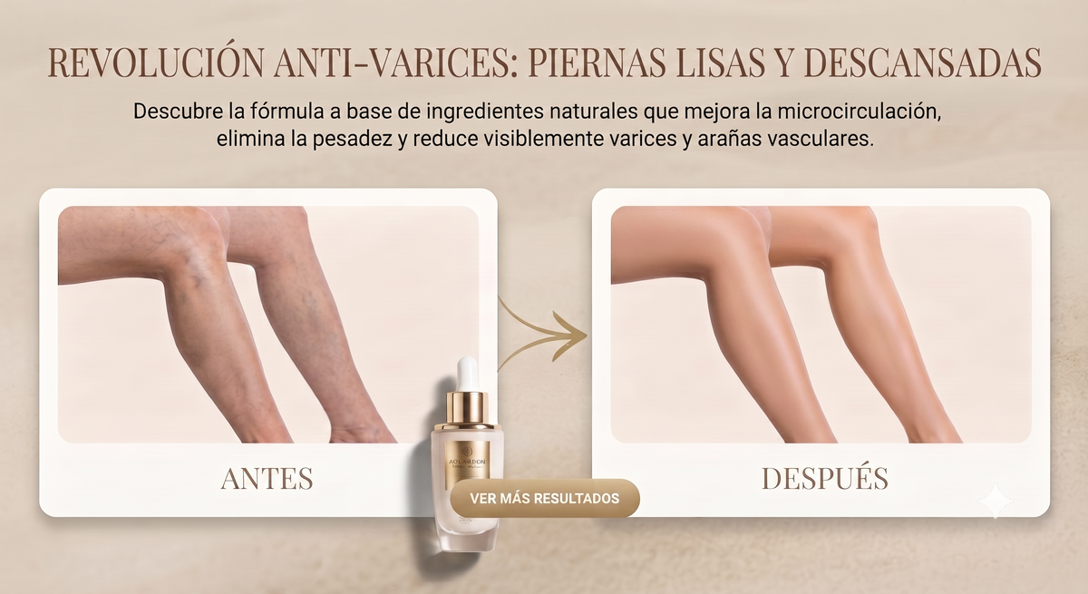 Spray para Varices Crioterapia Pro™