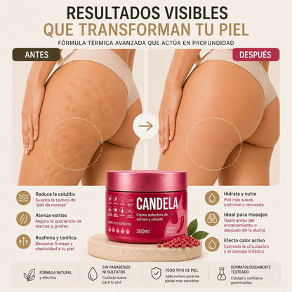 Crema Reductora de Estrías y Celulitis CANDELA