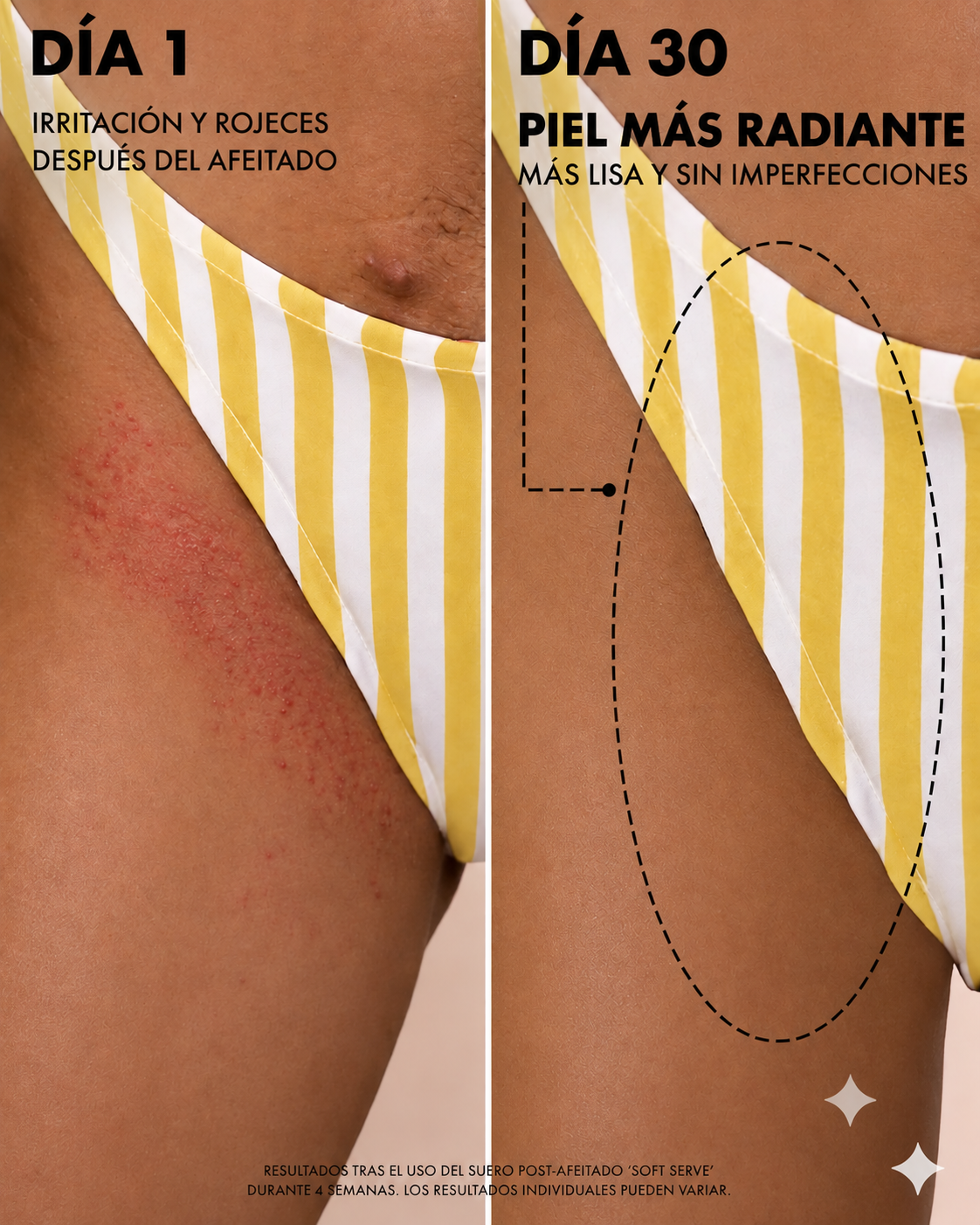 Aceite calmante after shave